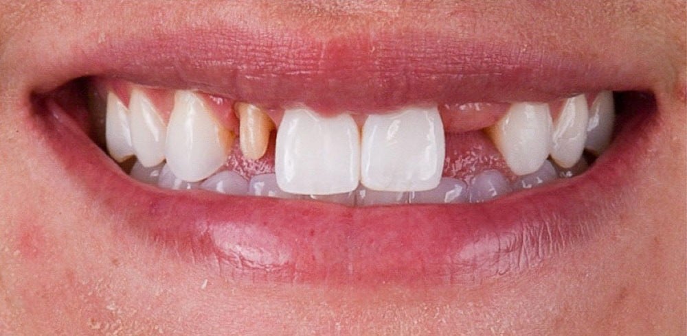 Before image