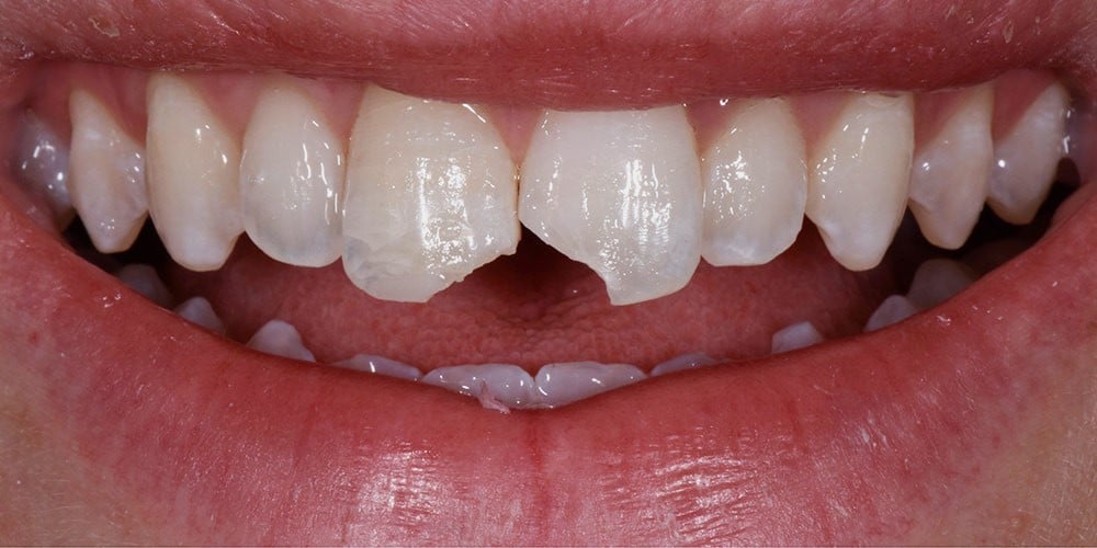 Before image